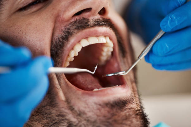 Urgent Tooth Repair in WY