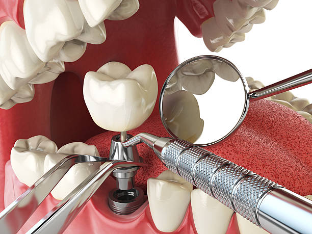 Reliable WY Emergency Dentist Solutions